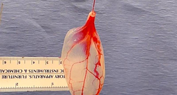 170327-spinach-leaf-human-heart-tissue-vin ds1702001-104 640x360 907435587711