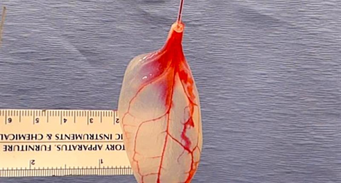 170327-spinach-leaf-human-heart-tissue-vin ds1702001-104 640x360 907435587711